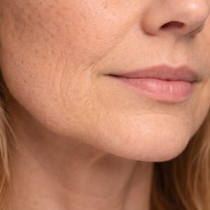 CAVIAR SUPREME LIFTING