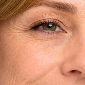 TERMIKUS IONIZÁCIÓ SOFT ELJÁRÁS