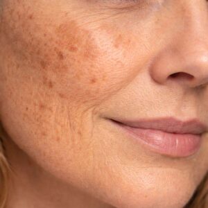 UTSUKUSY D-SKIN RITUÁLÉ