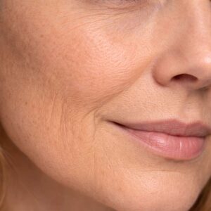 UTSUKUSY EXOSKIN PROTOKOLL-BŐRMEGÚJÍTÓ HATÓANYAG KEZELÉS