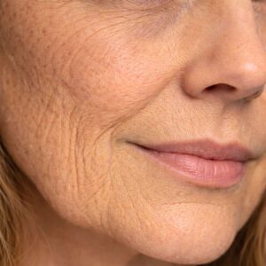 VITAMIN GLOW INFUSION